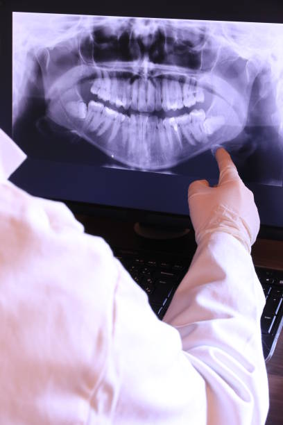 Best Cosmetic Emergency Dentistry in Santa Ana, CA